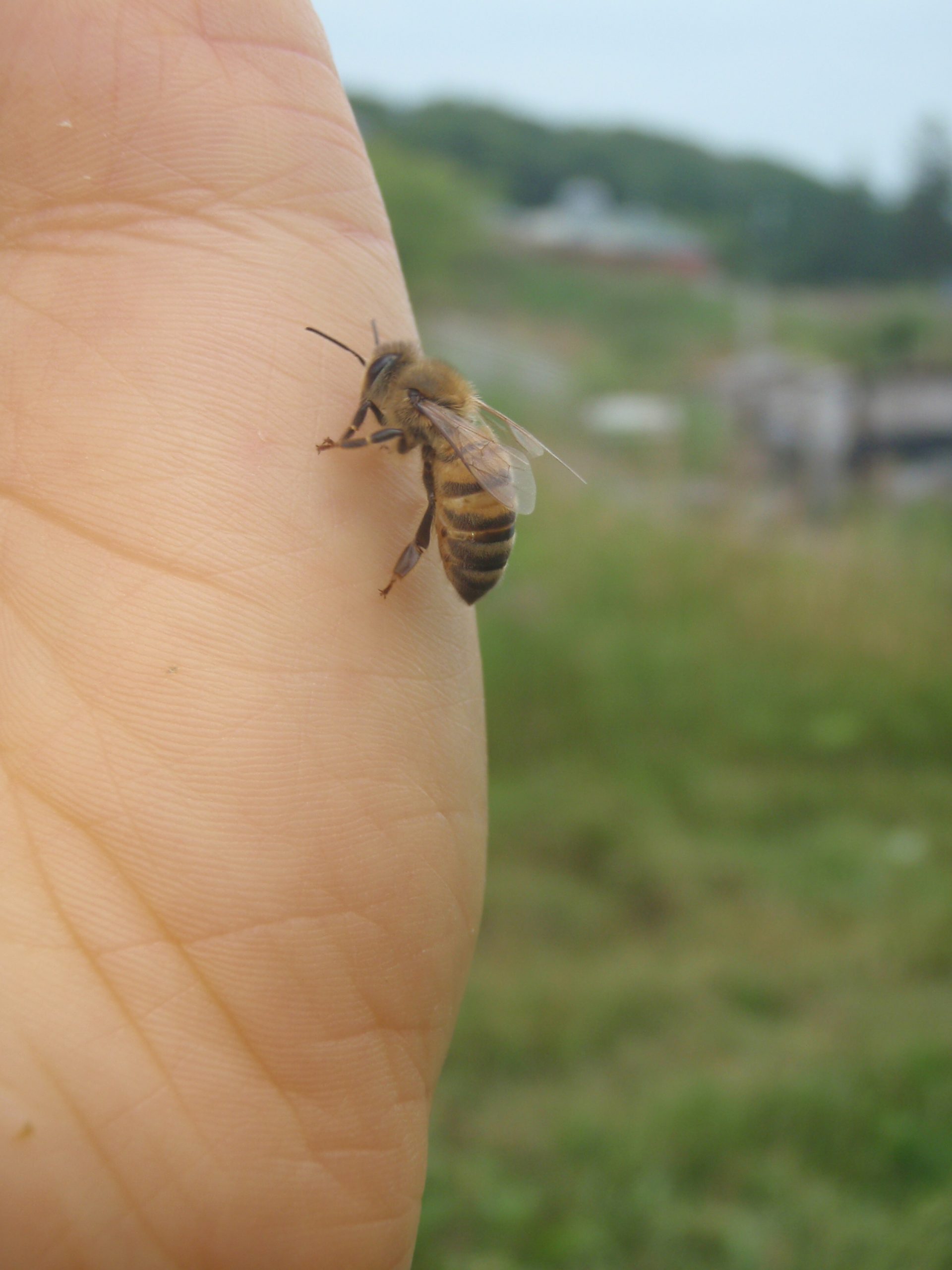 bee stings